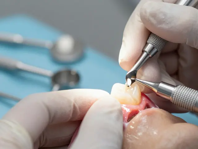 Fazety na přední zuby: Jaké jsou rizika a co byste měli vědět před rozhodnutím