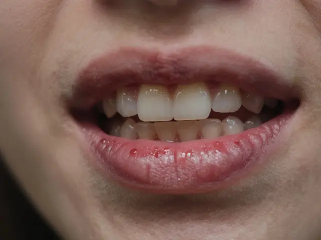 Jak černý zubní kámen ovlivňuje vaše pocity a zdraví úst