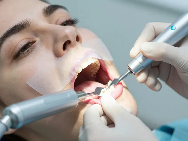 Jaká je účinnost kyretáže zubů? Vše, co potřebujete vědět o léčbě parodontitidy