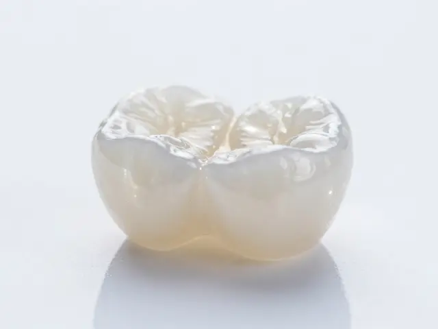 Celokeramické fazety: Cesta k dokonalému úsměvu a přirozenému vzhledu